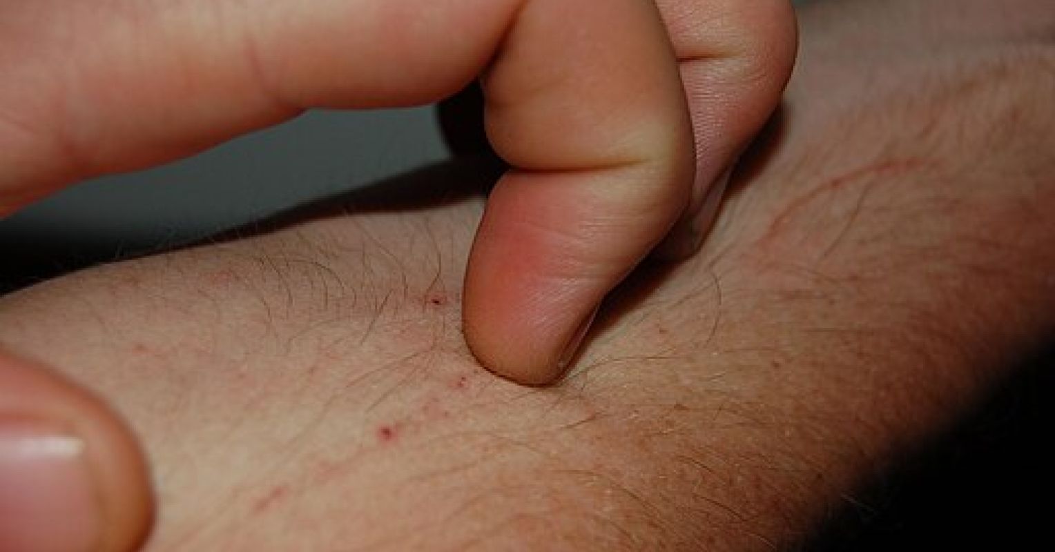 Itchy Words 1 OrrlingHandScratchingPruritus2010
