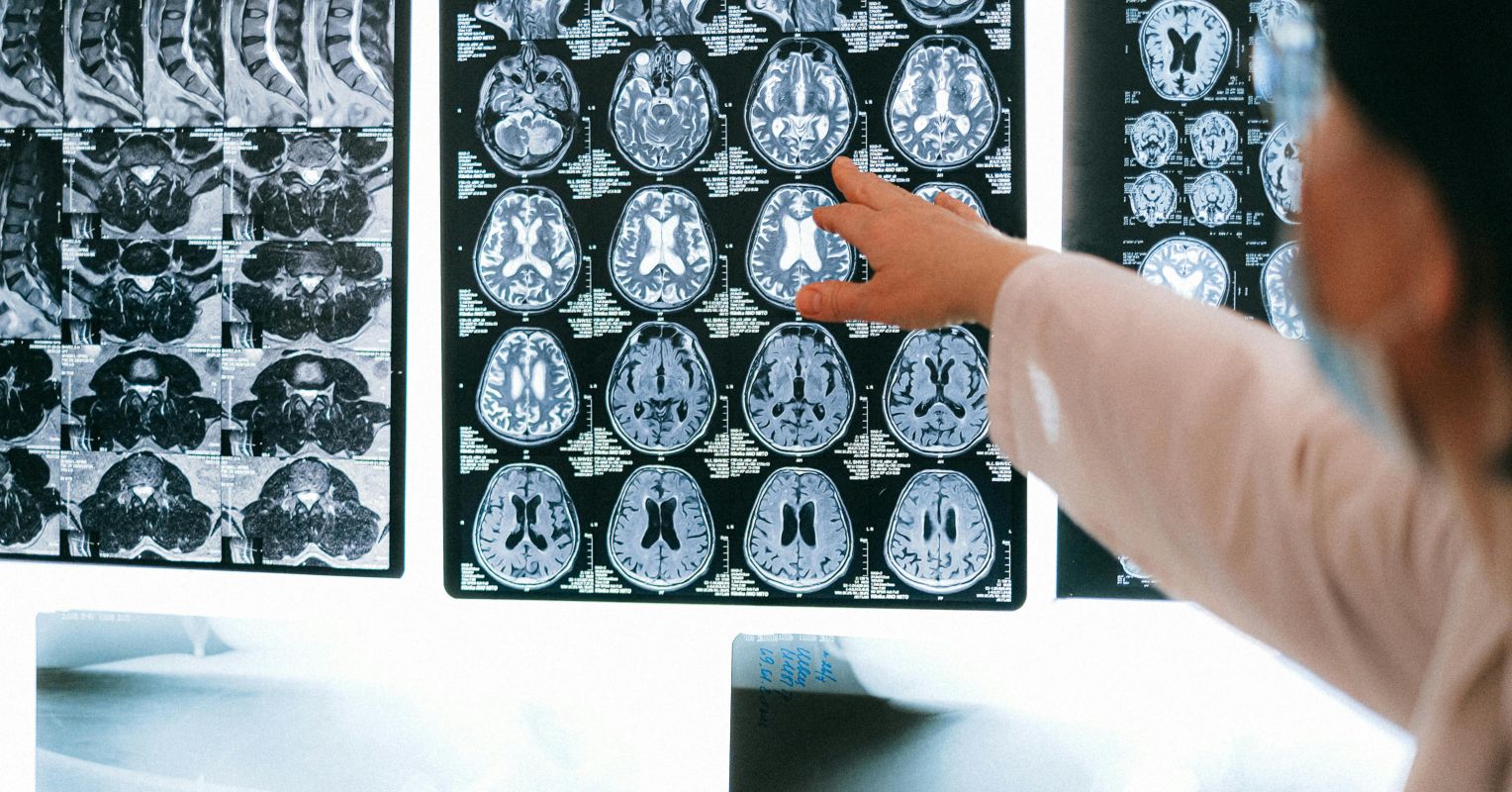 Toward Brain-Based Psychiatric Diagnosis 1 pexels shvetsa 4226264